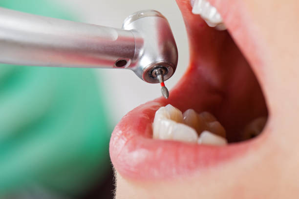 Best Cracked Tooth Emergency Dentist  in , MN